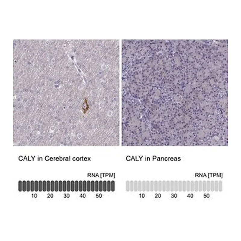 Merck Anti-CALY antibody produced in rabbit