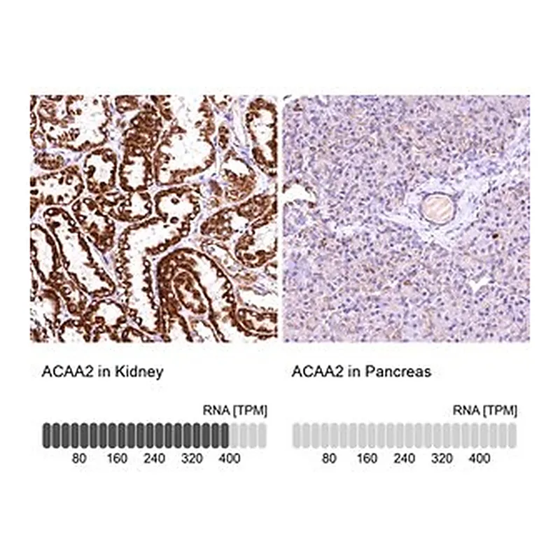 Merck Anti-ACAA2 antibody produced in rabbit
