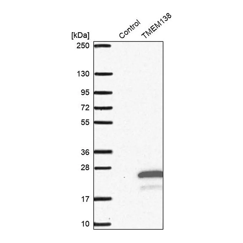 Merck Anti-TMEM138 antibody produced in rabbit