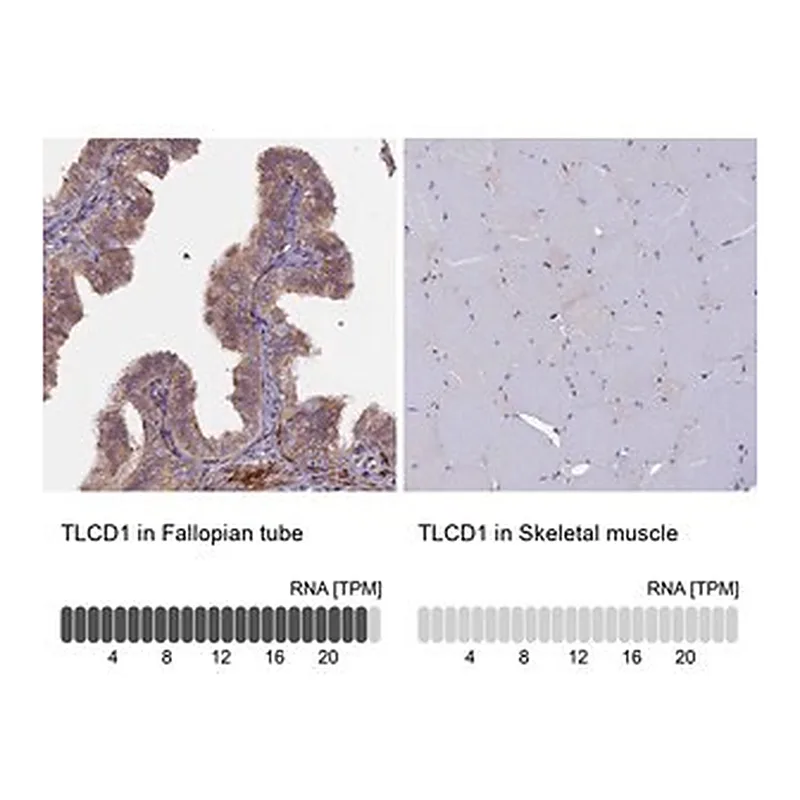 Merck Anti-TLCD1 antibody produced in rabbit