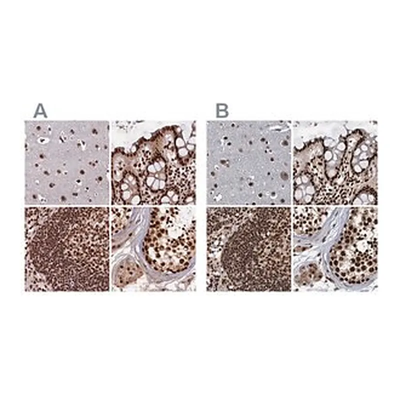Merck Anti-ZC3H18 antibody produced in rabbit