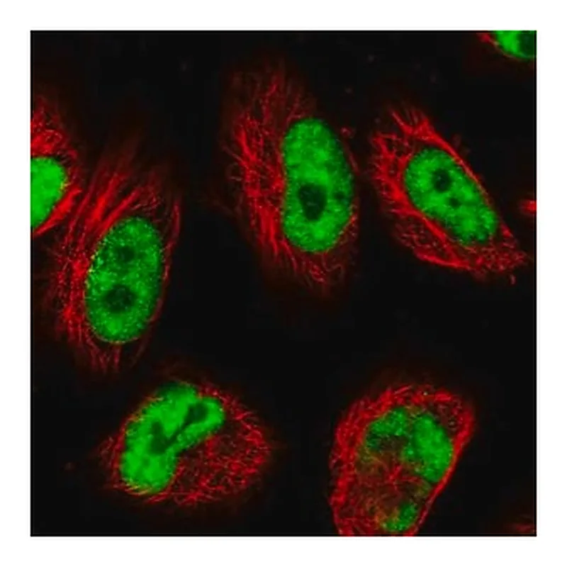 Merck Anti-USP22 antibody produced in rabbit