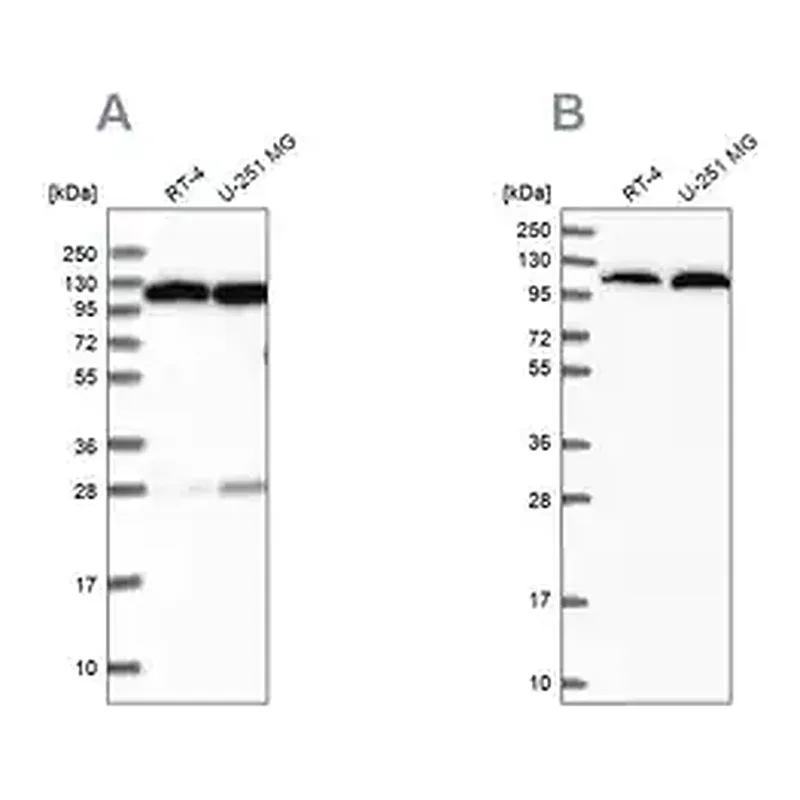 Merck Anti-AARS antibody produced in rabbit