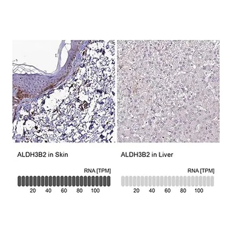 Merck Anti-ALDH3B2 antibody produced in rabbit
