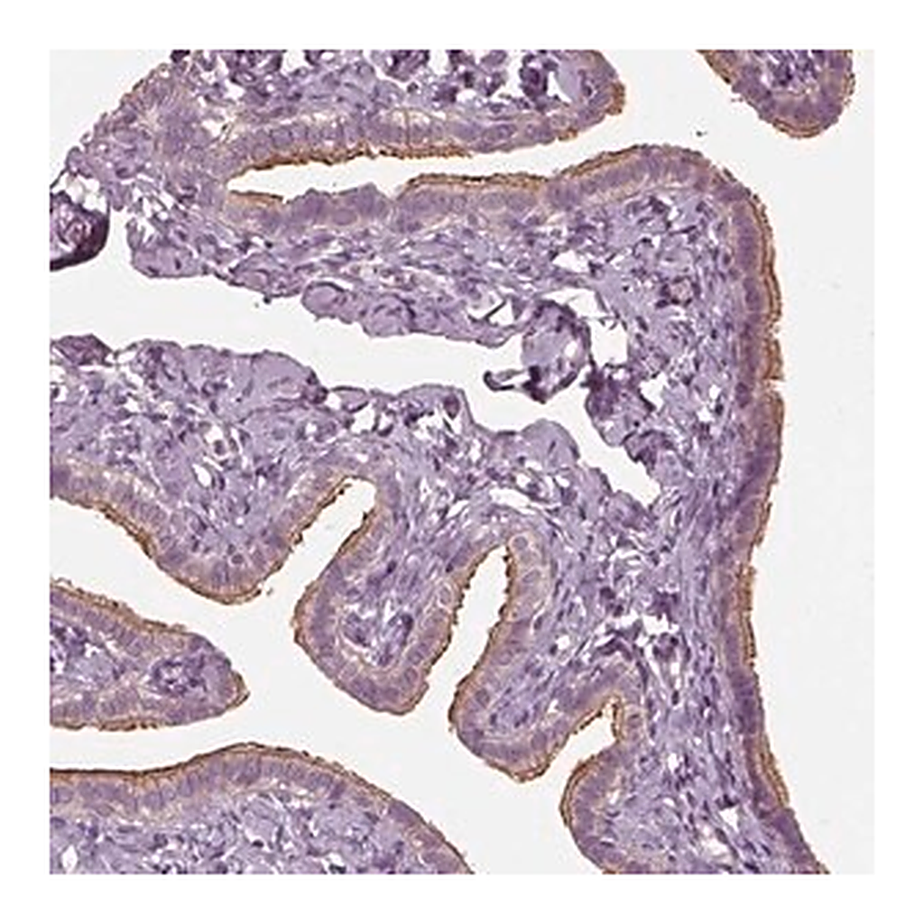 Merck Anti-CCDC114 antibody produced in rabbit