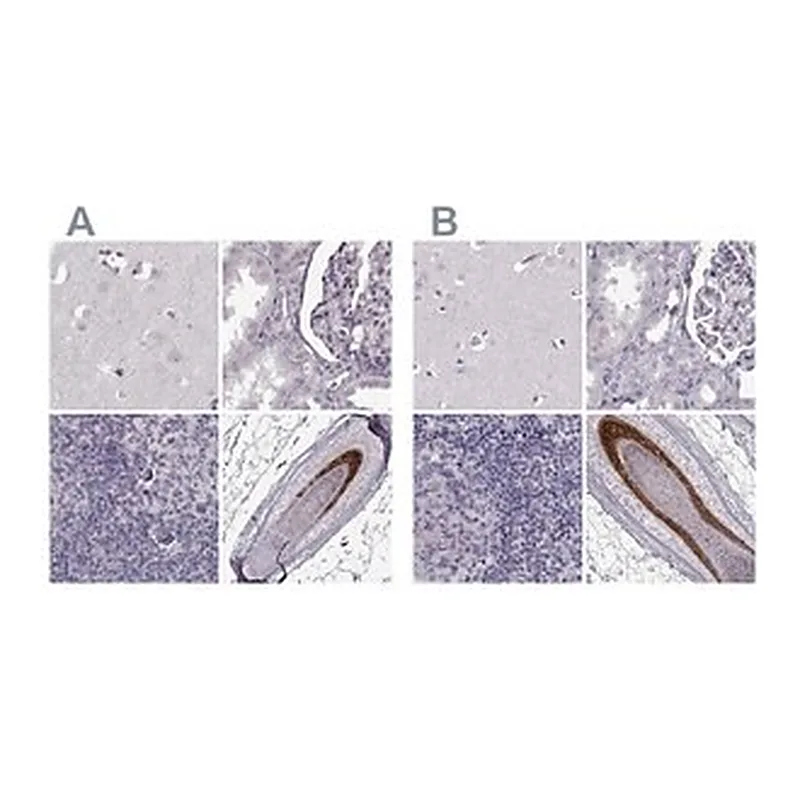 Merck Anti-TCHHL1 antibody produced in rabbit