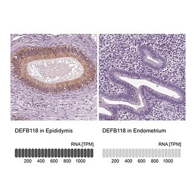 Merck Anti-DEFB118 antibody produced in rabbit