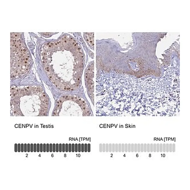 Merck Anti-CENPV antibody produced in rabbit