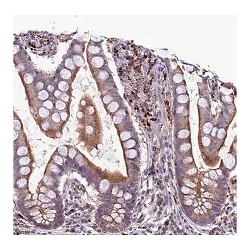 Merck Anti-ARHGEF18 antibody produced in rabbit