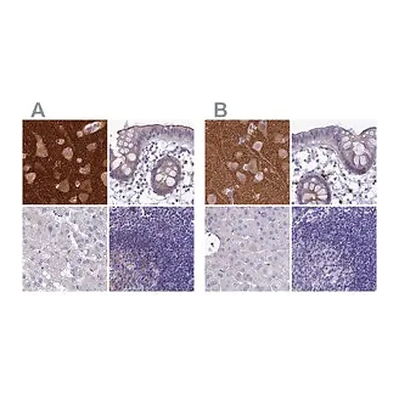 Merck Anti-SNAP91 antibody produced in rabbit