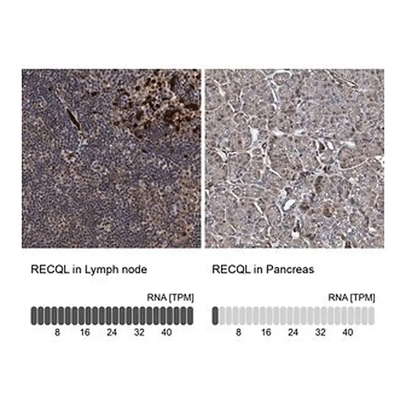 Merck Anti-RECQL antibody produced in rabbit