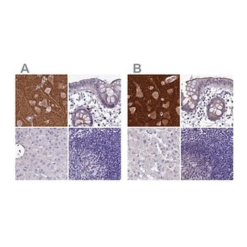 Merck Anti-SNAP91 antibody produced in rabbit