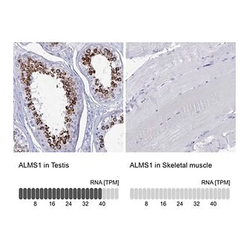 Merck Anti-ALMS1 antibody produced in rabbit