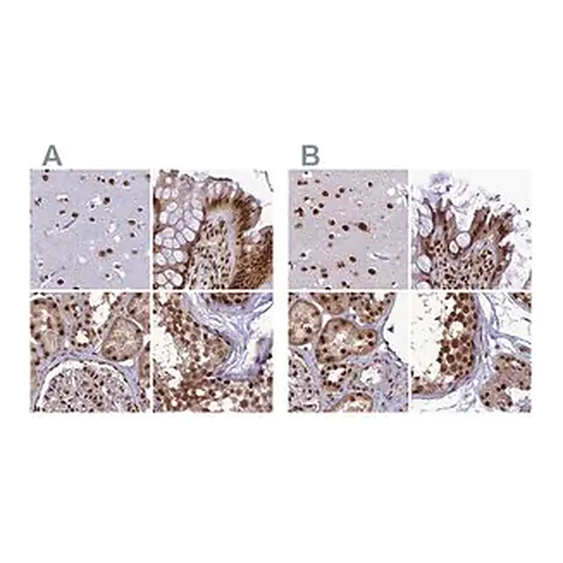 Merck Anti-DDX1 antibody produced in rabbit