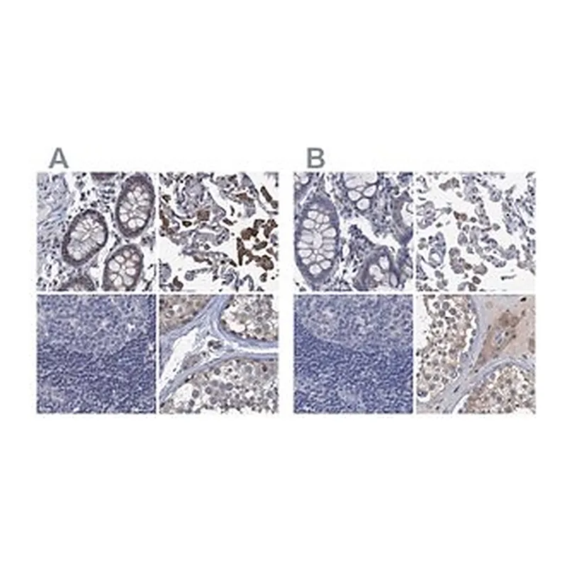 Merck Anti-RTKN2 antibody produced in rabbit