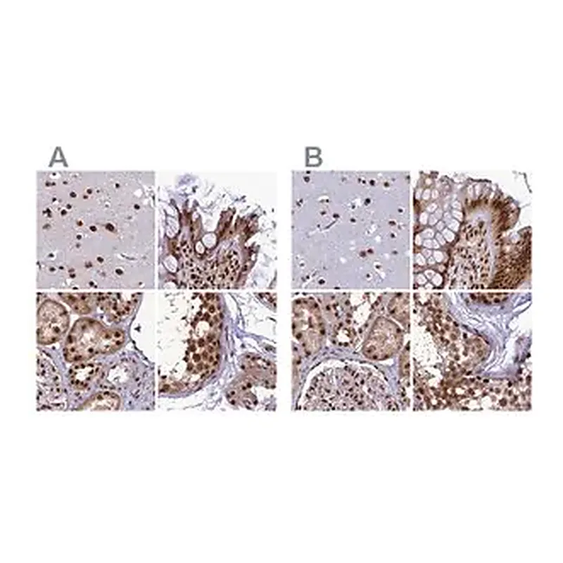 Merck Anti-DDX1 antibody produced in rabbit