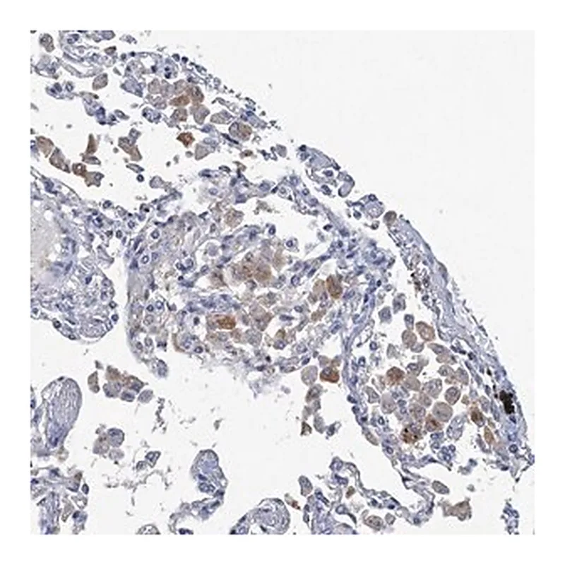 Merck Anti-RTKN2 antibody produced in rabbit