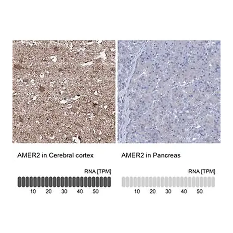 Merck Anti-AMER2 antibody produced in rabbit