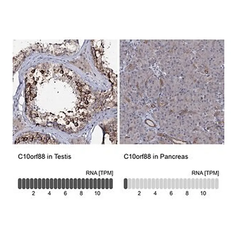 Merck Anti-C10orf88 antibody produced in rabbit