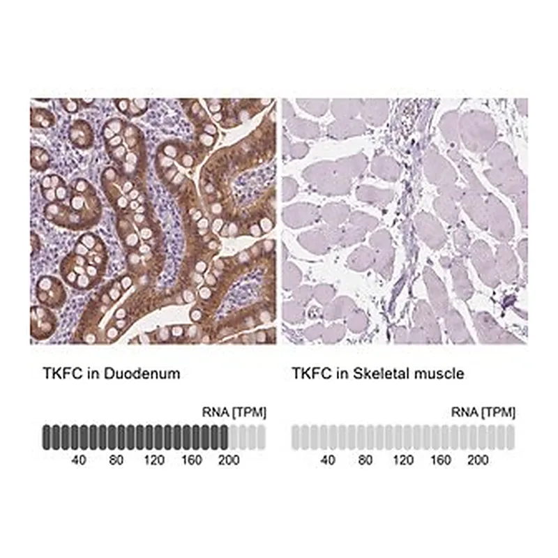Merck Anti-TKFC antibody produced in rabbit