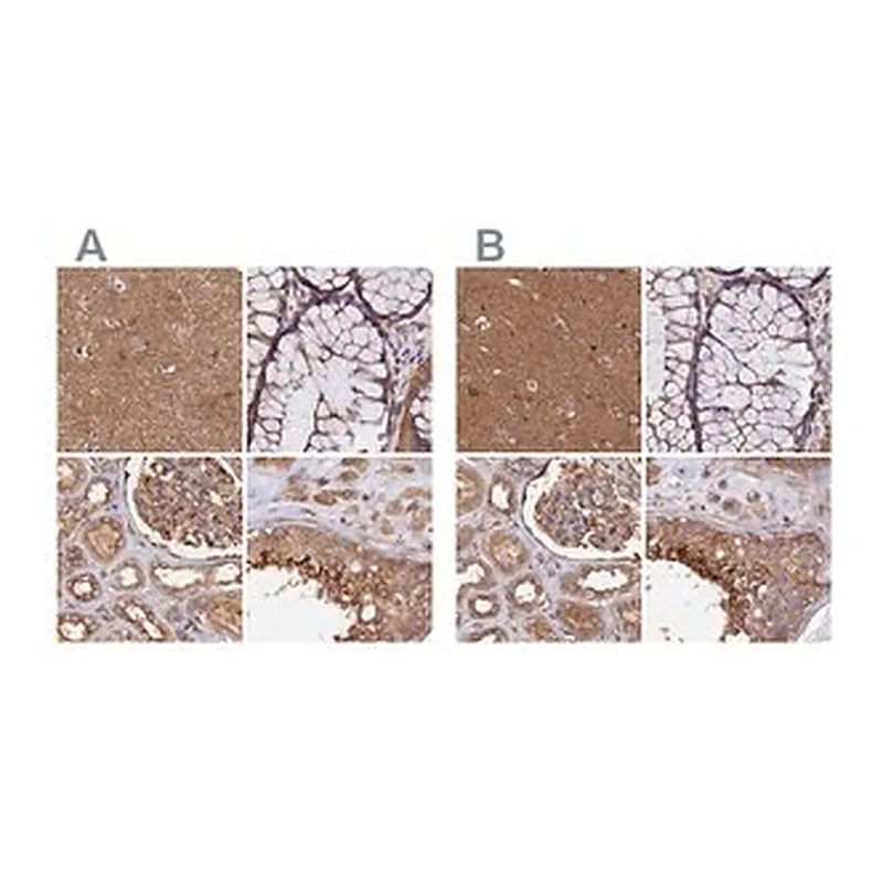 Merck Anti-DCTN2 antibody produced in rabbit