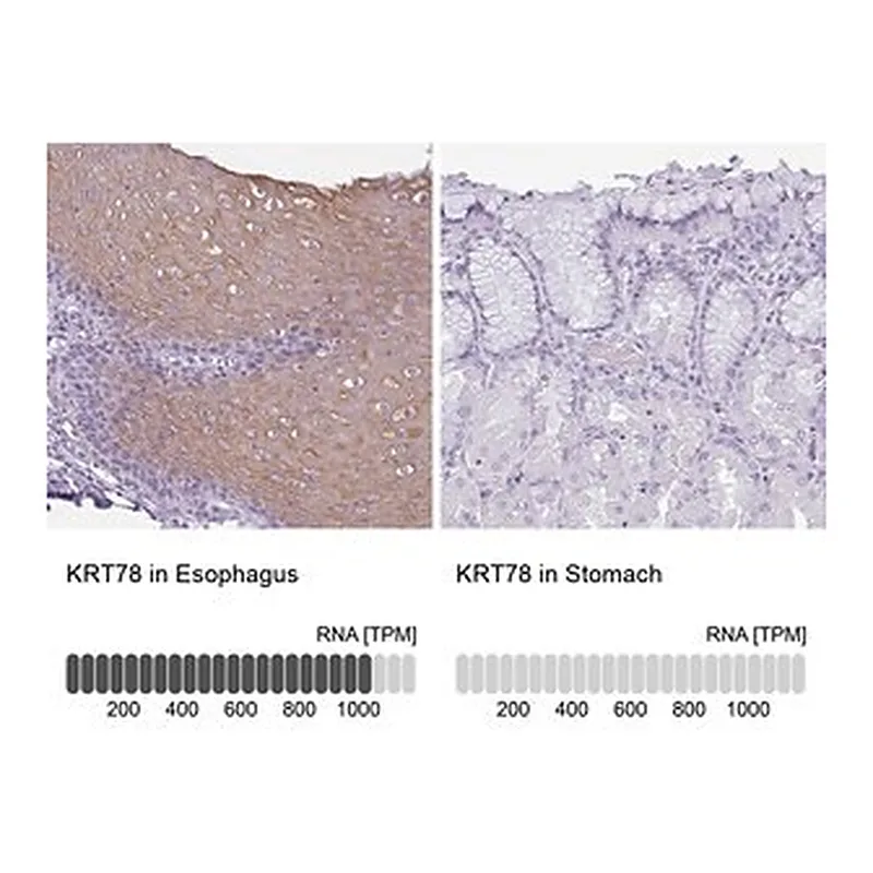 Merck Anti-KRT78 antibody produced in rabbit
