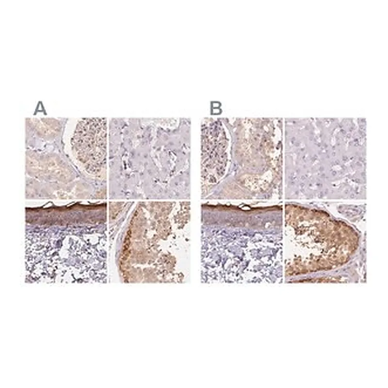 Merck Anti-BLMH antibody produced in rabbit