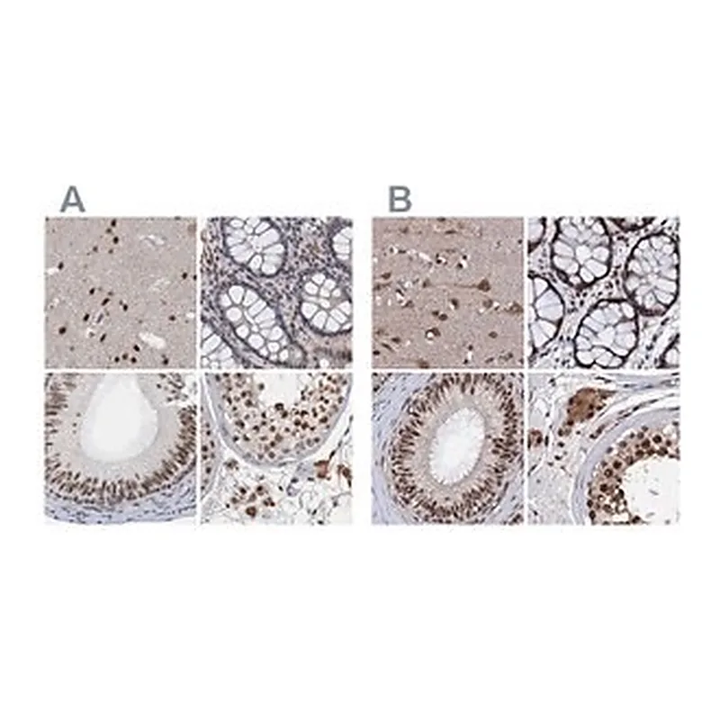Merck Anti-CSTF3 antibody produced in rabbit
