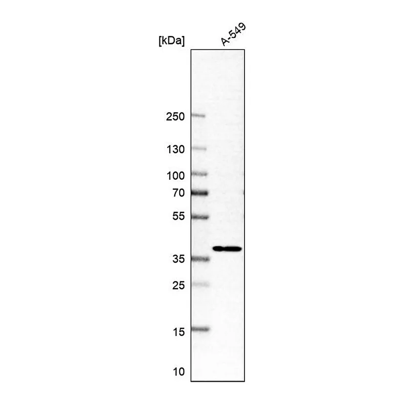Merck Anti-MFSD5 antibody produced in rabbit