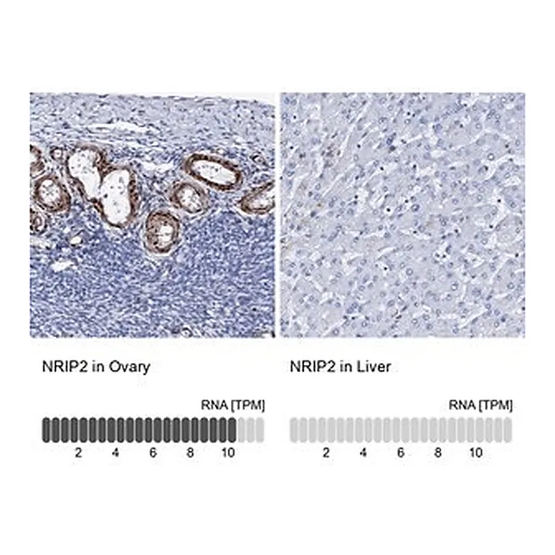 Merck Anti-NRIP2 antibody produced in rabbit