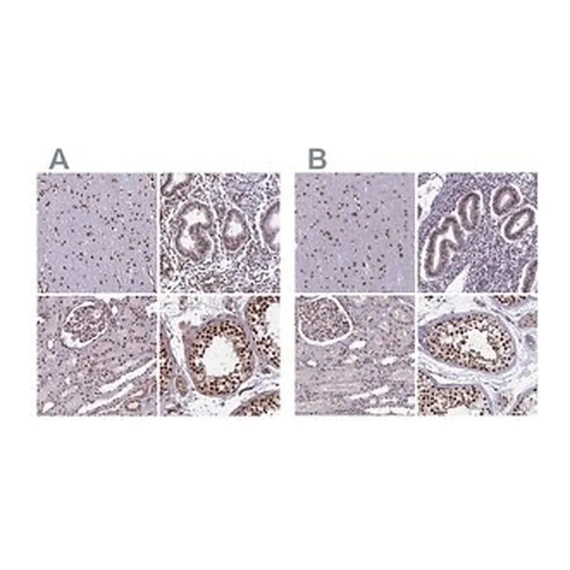 Merck Anti-MPHOSPH8 antibody produced in rabbit