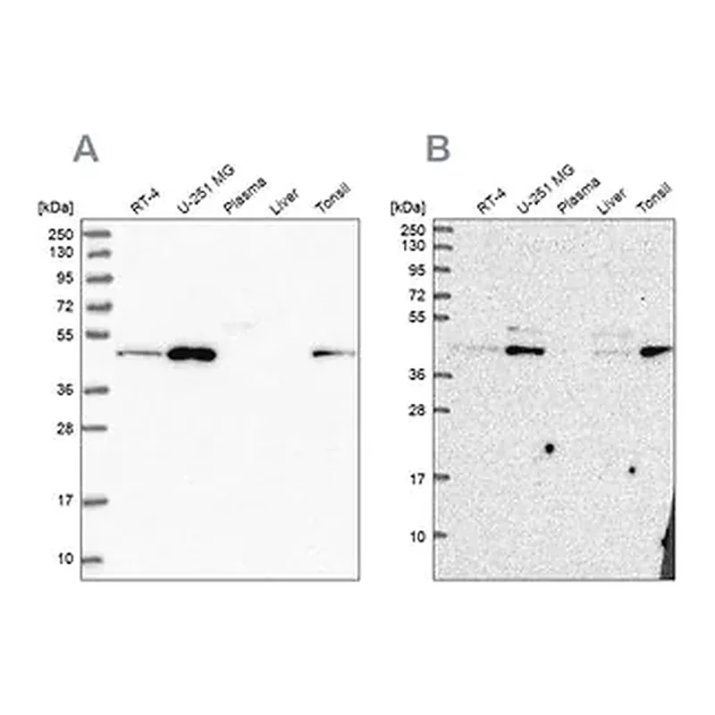 Merck Anti-ZDHHC16 antibody produced in rabbit