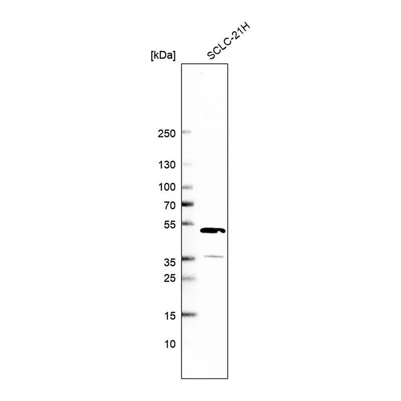 Merck Anti-CLYBL antibody produced in rabbit
