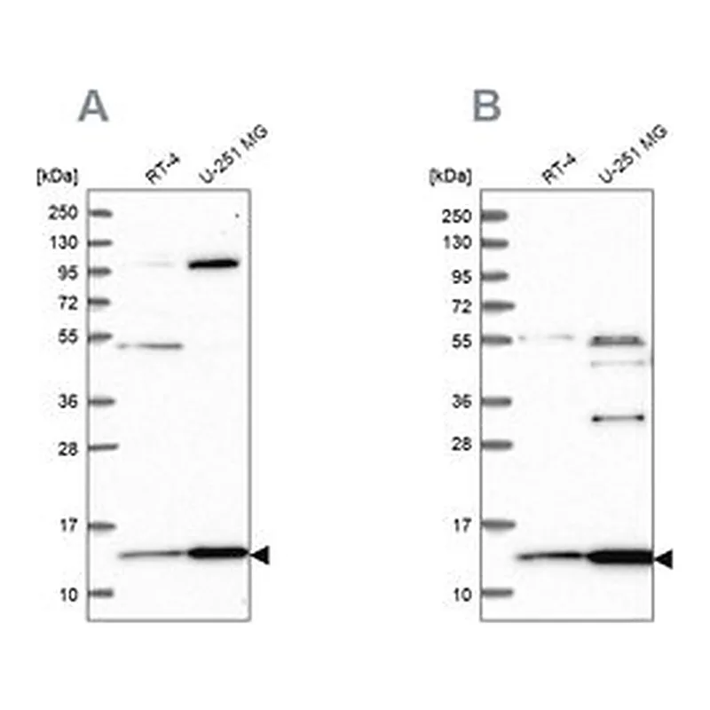 Merck Anti-TRMT112 antibody produced in rabbit