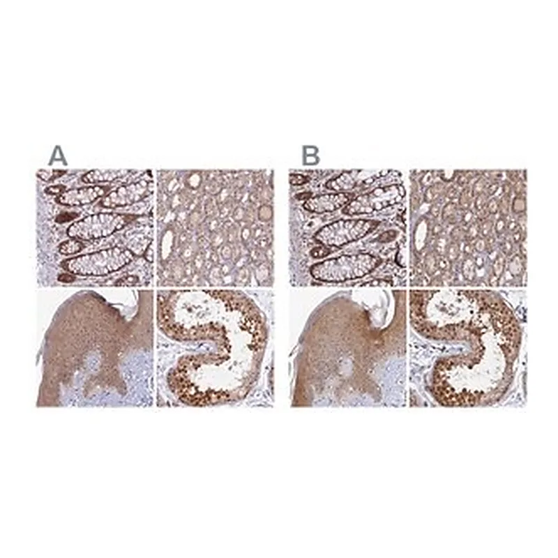 Merck Anti-WDR61 antibody produced in rabbit