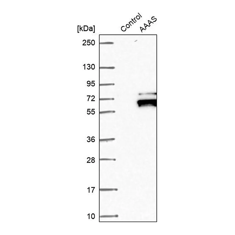 Merck Anti-AAAS antibody produced in rabbit