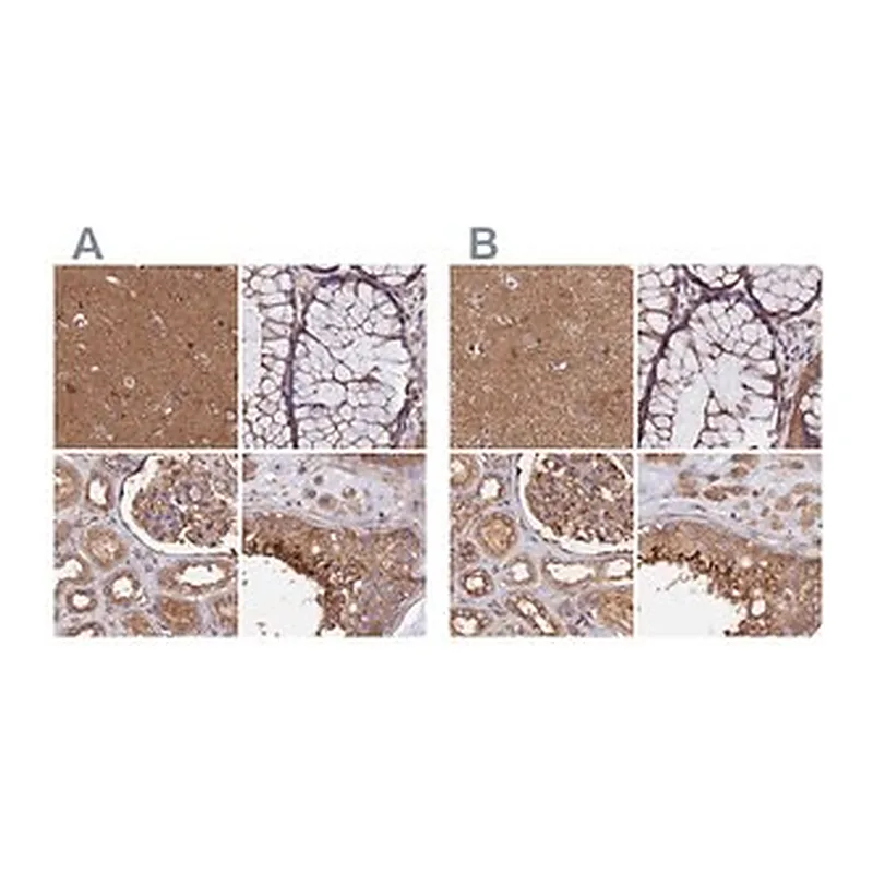 Merck Anti-DCTN2 antibody produced in rabbit
