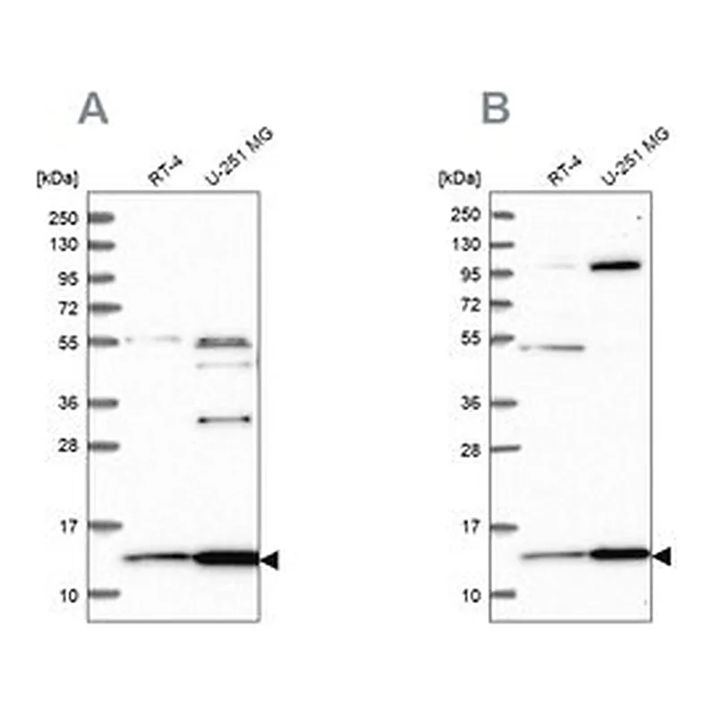 Merck Anti-TRMT112 antibody produced in rabbit