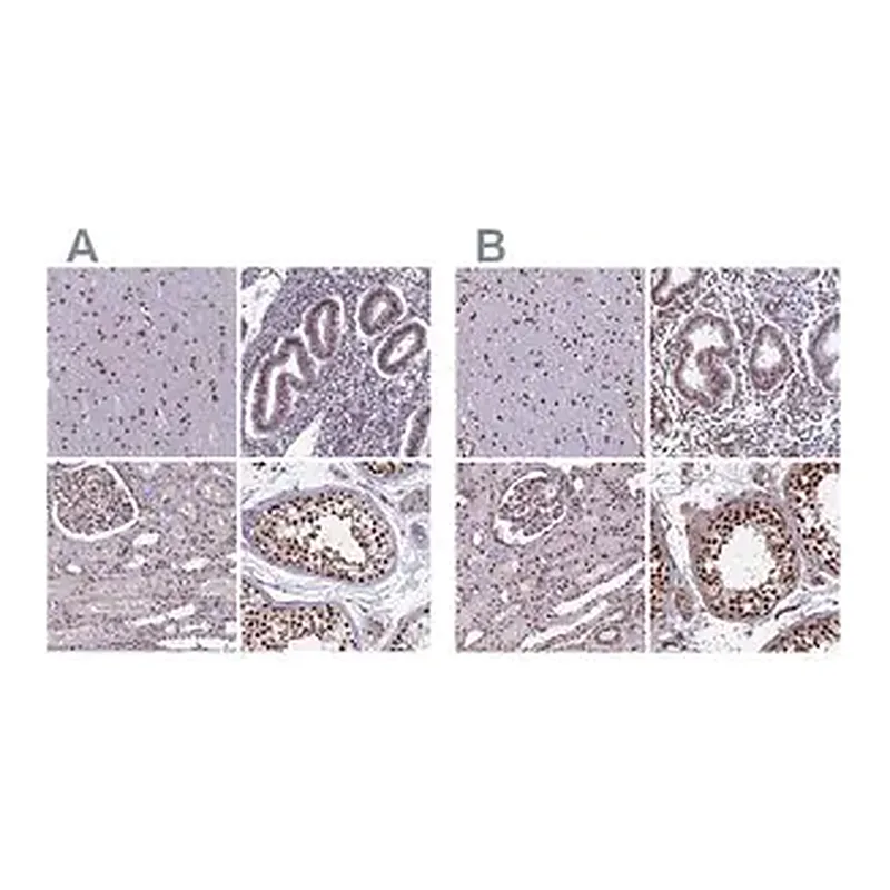 Merck Anti-MPHOSPH8 antibody produced in rabbit