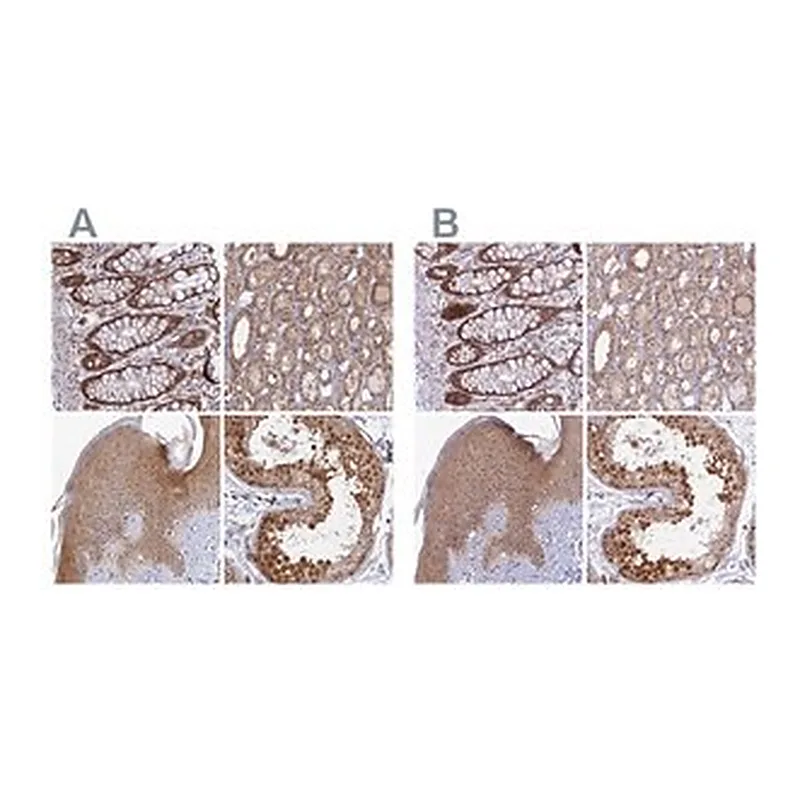 Merck Anti-WDR61 antibody produced in rabbit