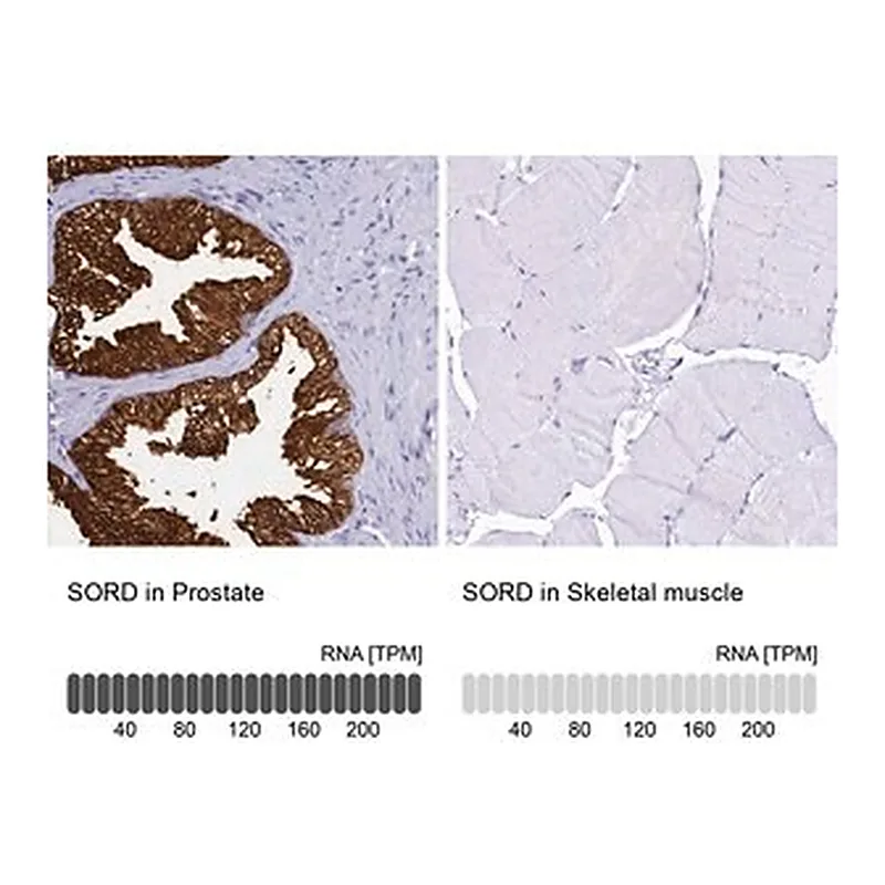 Merck Anti-SORD antibody produced in rabbit