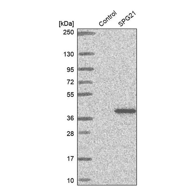 Merck Anti-SPG21 antibody produced in rabbit