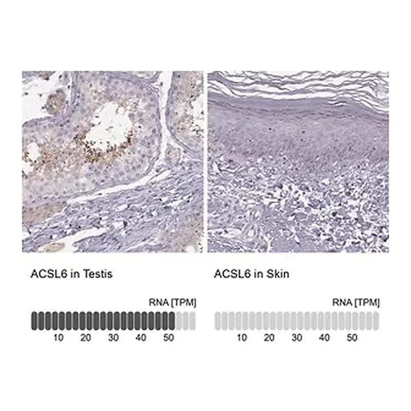 Merck Anti-ACSL6 antibody produced in rabbit