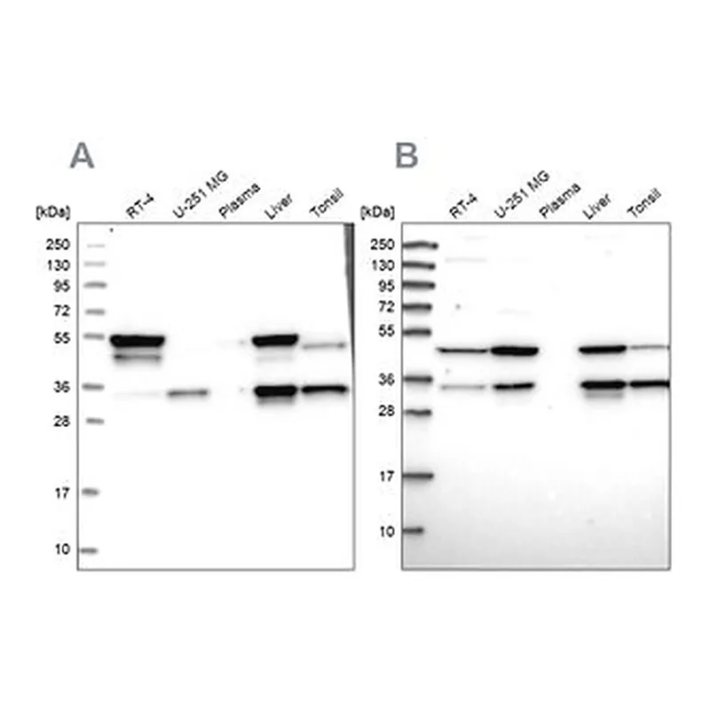 Merck Anti-CLYBL antibody produced in rabbit