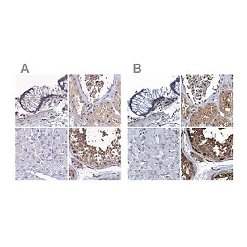 Merck Anti-RNH1 antibody produced in rabbit