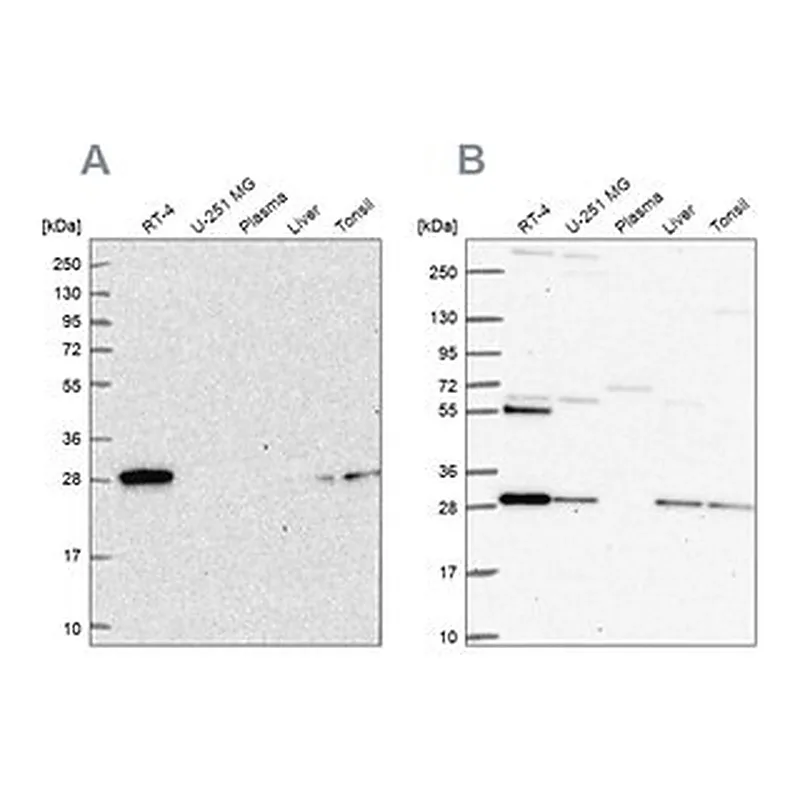 Merck Anti-PMM2 antibody produced in rabbit