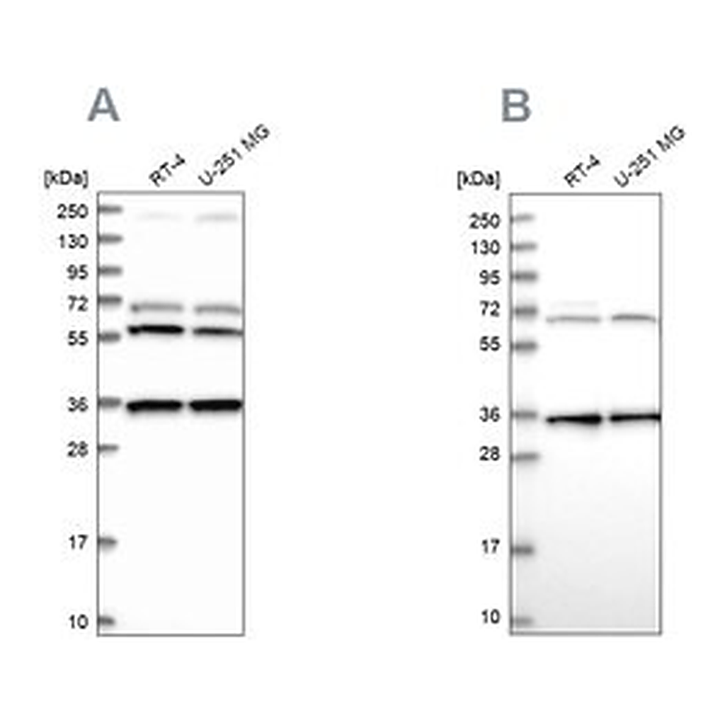 Merck Anti-DNAJC17 antibody produced in rabbit