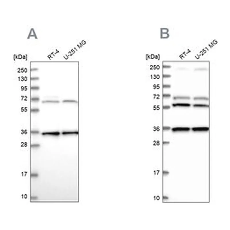Merck Anti-DNAJC17 antibody produced in rabbit