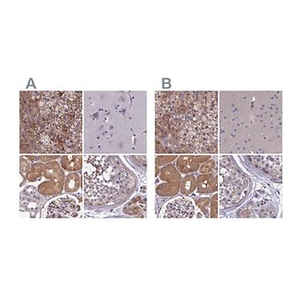 Merck Anti-AMDHD2 antibody produced in rabbit