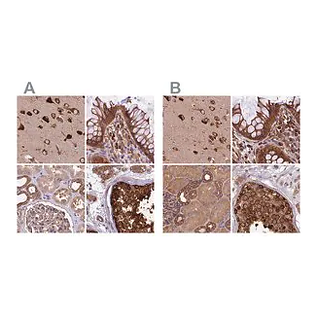 Merck Anti-KARS antibody produced in rabbit